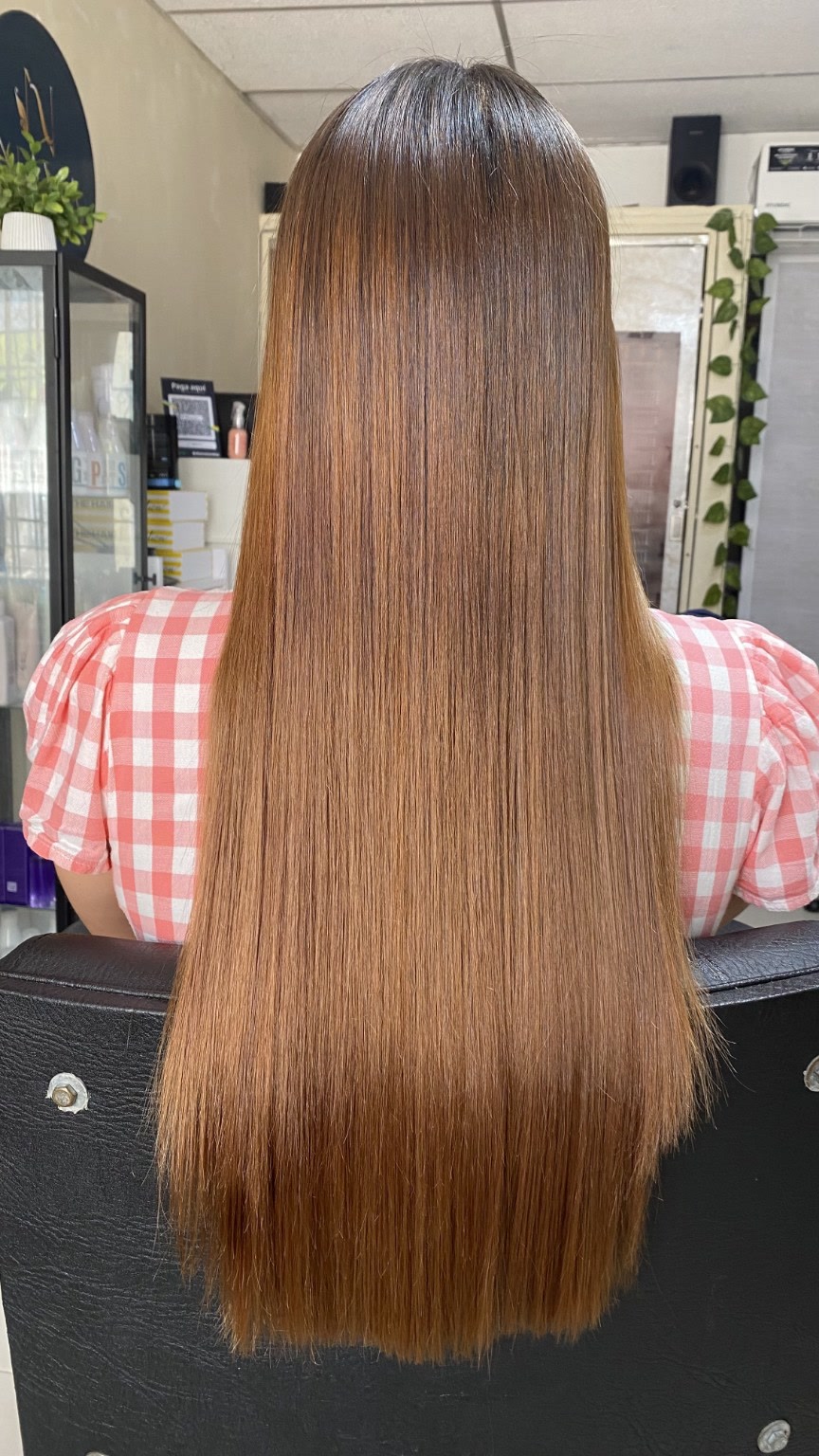 Resultado real de luminoplastia NAVA